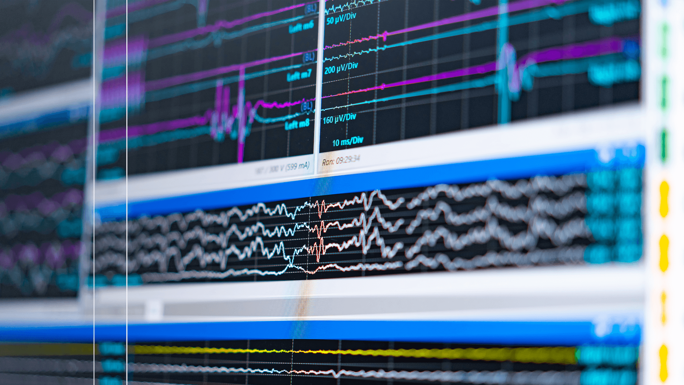 Screen with brainwave data