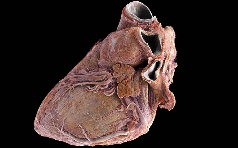 Rendering of the healthy heart. Credit: Siemens Healthineers 2024; Data UCL led ESRF Beamtime 1290.